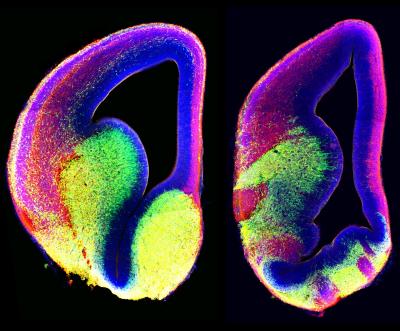 Mutations in Arl13b Gene Disrupts Brain Organization