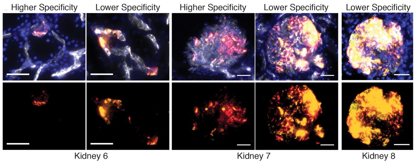 Potential Treatments for Transplant Organs with Targeted Nanoparticles that Persist after Perfusion (3 of 3)