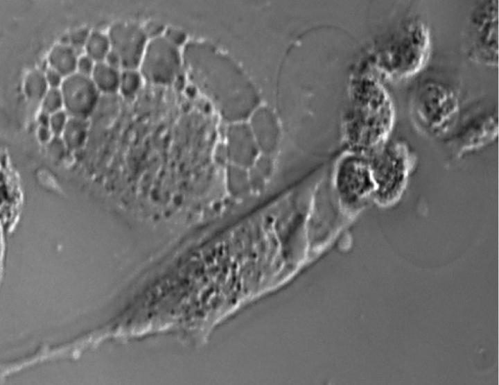 Cell-Surface Discovery May Fundamentally Alter Cancer Treatment (2 of 2)