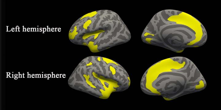 Cortical Thickness