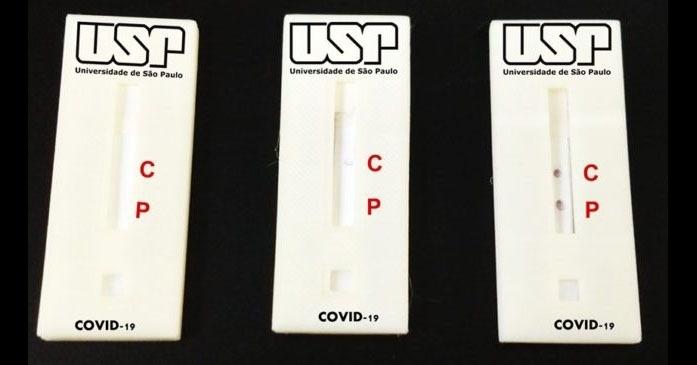 Novel coronavirus test