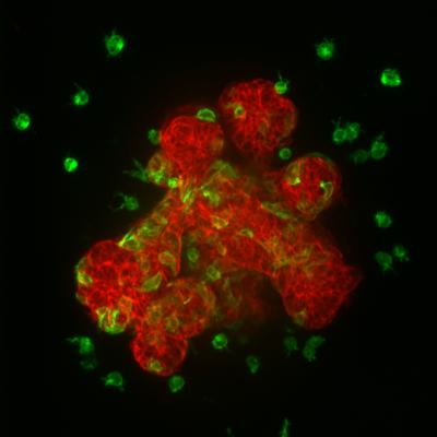 Twist1 Induces Cellular Migration