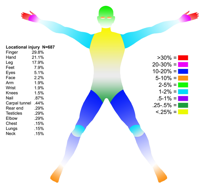 A color-coded figure illustrates that flintknapping injuries are not just limited to the hands.