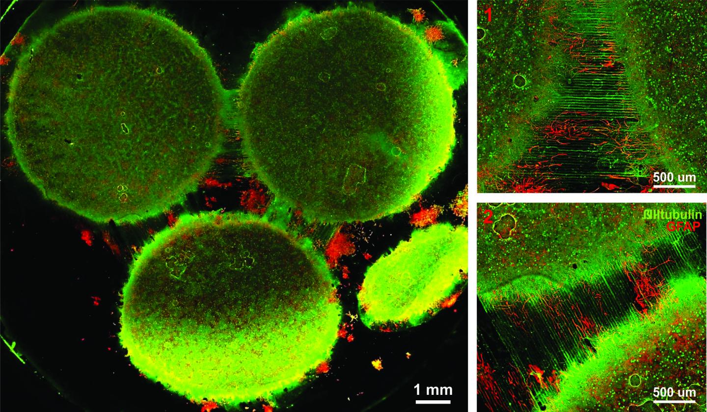 Multiregional Brain-on-a-Chip