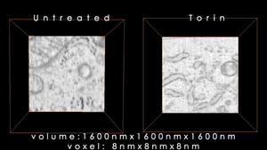 Enhanced FIB-SEM images of untreated and nutrient-starved cells (200 voxels)