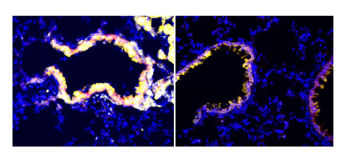 Immunofluorescent images of lungs treated with radiation (left) or no radiation (right). Club cells secrete more anti-immunosuppressive factors when treated with radiation, as seen by the increase in the secretory marker CC10 (yellow).