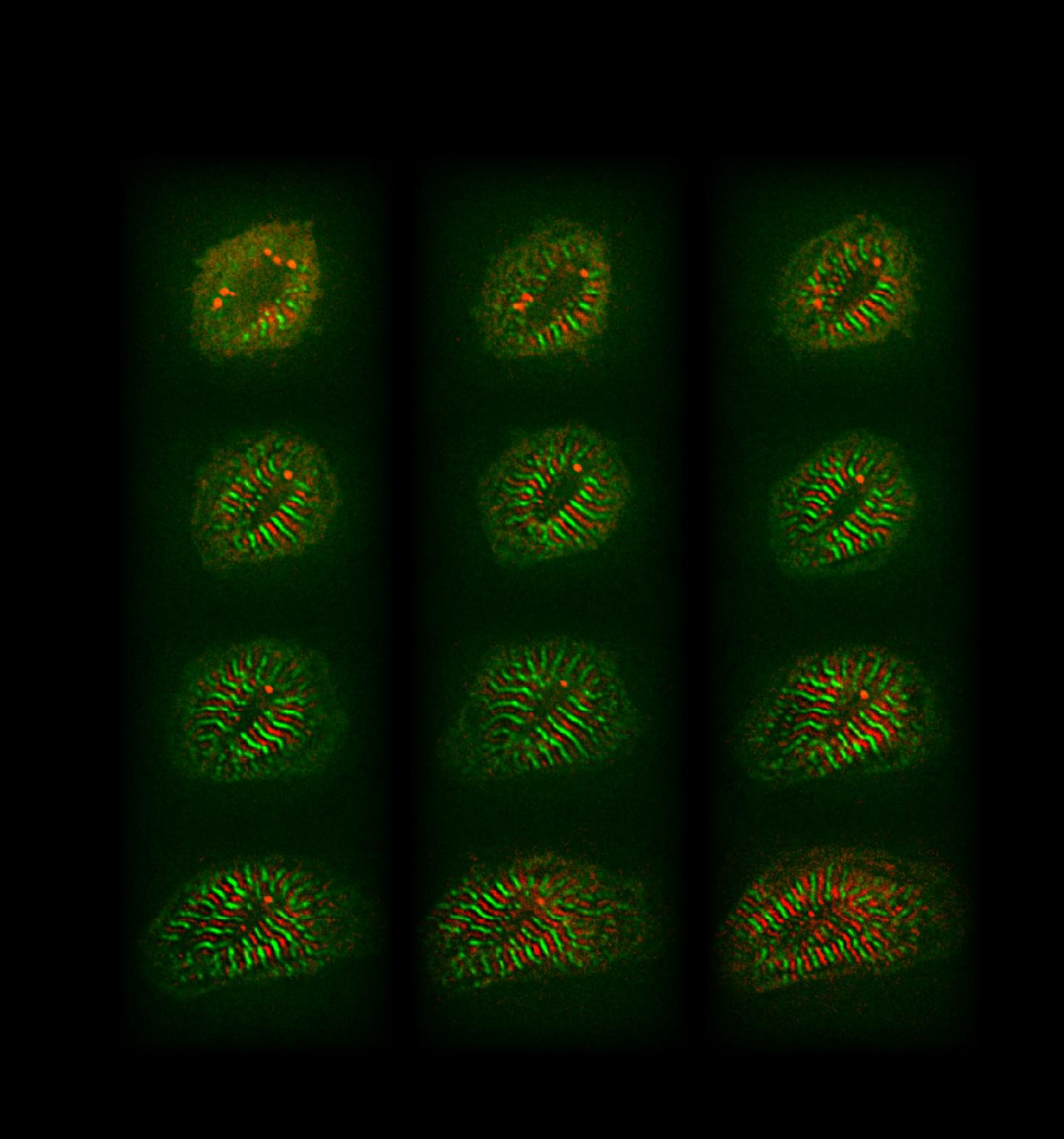 How Cardiomyocytes Remodel