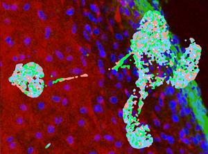 Transitioning cells