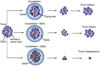 Resistance of Cancer Stem-like Cells to Cryoablation