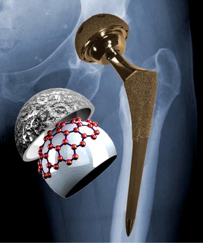 Metal-on-Metal Implant