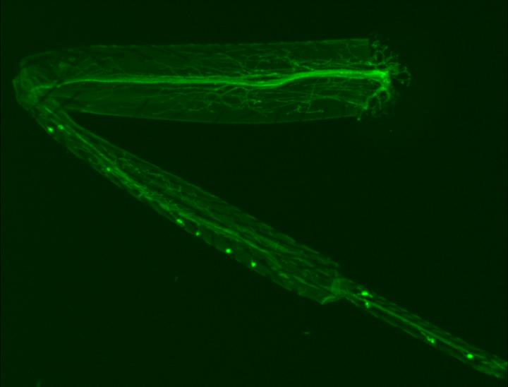 GFP-Labelled <em>Drosophila</em> Fly Leg Showing Motor Neurons