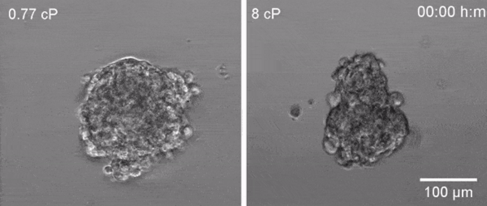cells from a tumour made up of breast cancer cells detach more quickly and travel more in high viscosity
