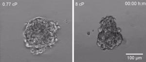 cells from a tumour made up of breast cancer cells detach more quickly and travel more in high viscosity