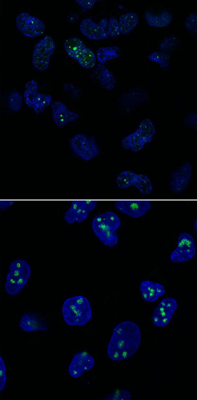 Skin Cells from Patients with Roberts Syndrome
