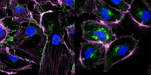 Pseudomonas aeruginosa Bacteria produce a molecule that paralyzes immune system cells