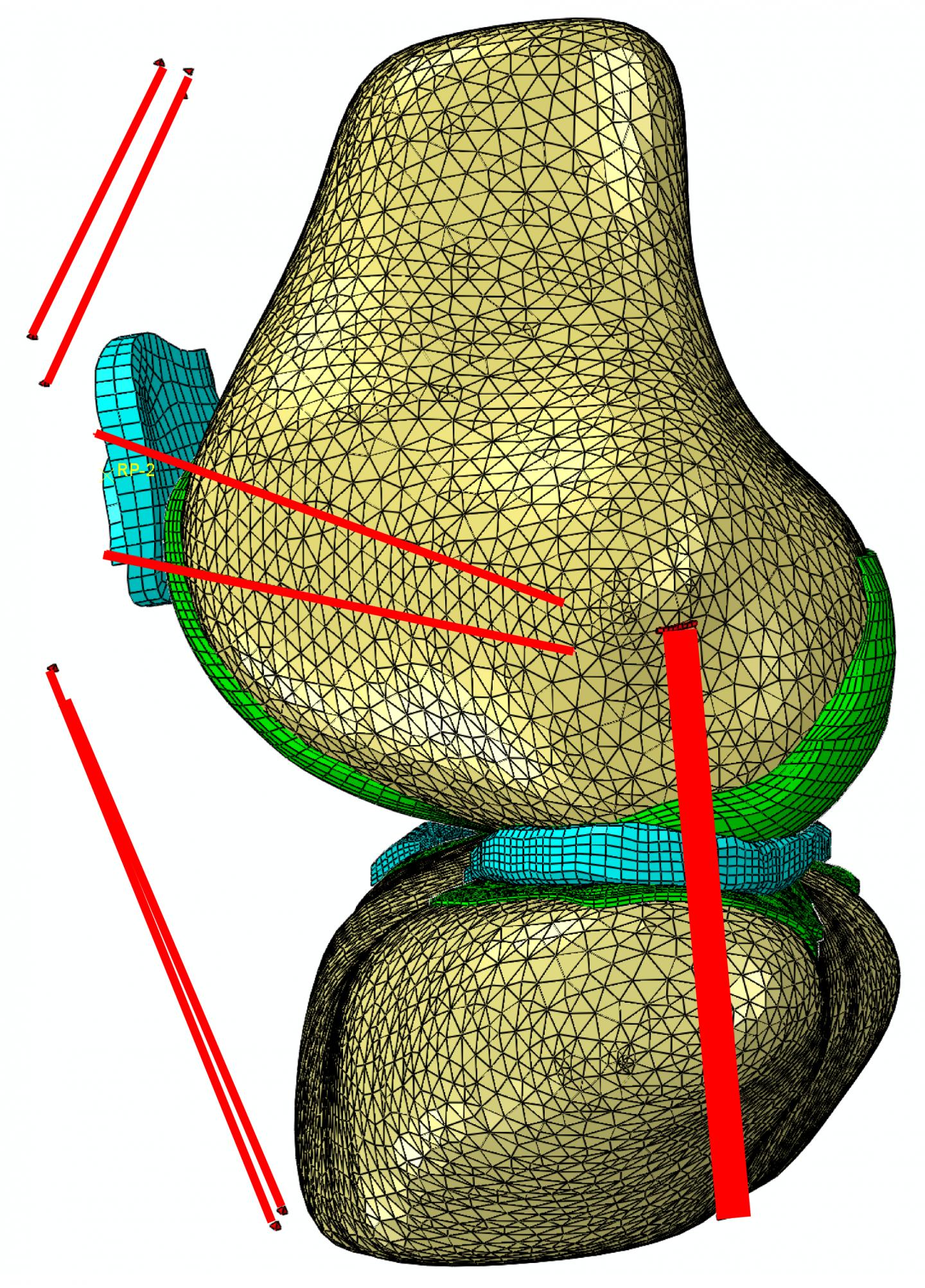 3-D Model of the Test Subject's Knee