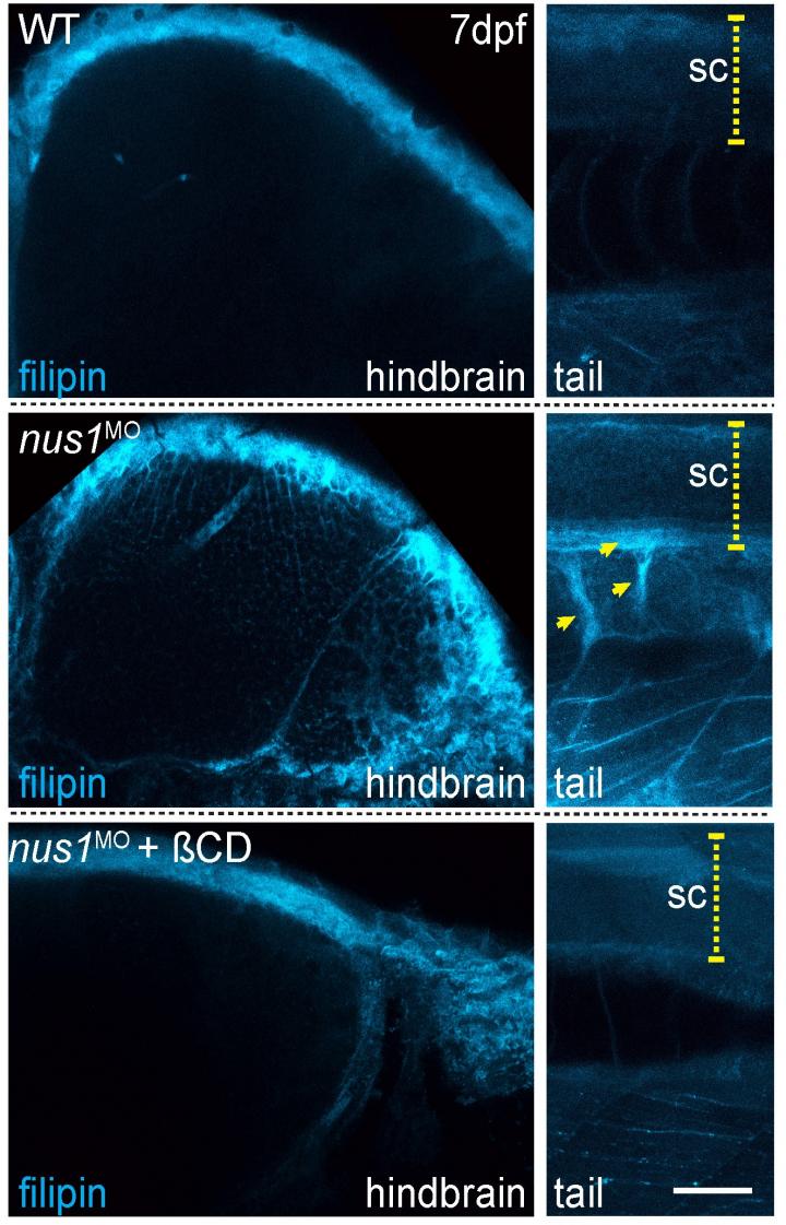 Cholesterol accumulation in zebrafish with NUS1 variants