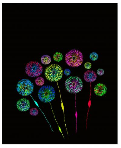Neural Rosettes Derived from Human iPSCs