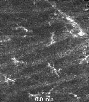 Imaging Macrophages In Human Eyes Eurekalert