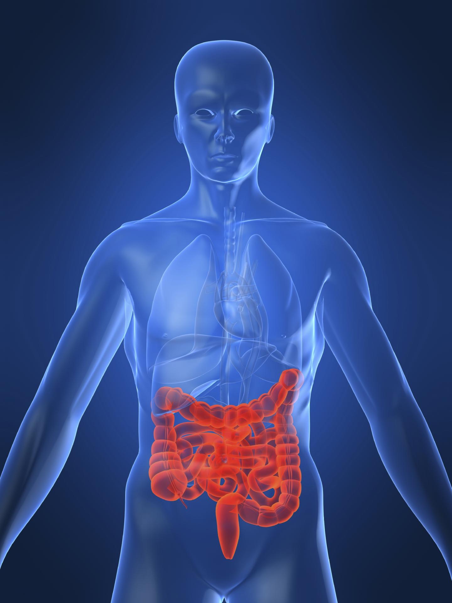 Crohn's disease is an inflammatory bowel disease - Mayo Clinic News Network