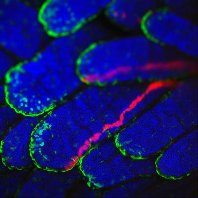 Cells with Mutations Don't Always Win (2 of 4)