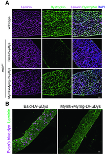 Lentivirus vector shows promise as potential treatment for Duchenne muscular dystrophy