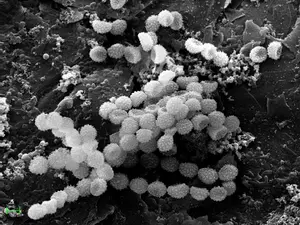 Scanning electron microphotography showing multiple microbial species in the biopurifier after 8 months of operation: Aspergillus fumigatus
