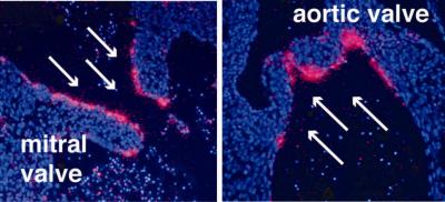 How Blood Flow Dictates Gene Expression