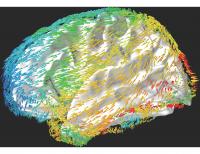 Still: Waves Move Across the Human Brain to Support Memory