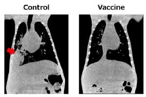 X-rays showing the efficacy of the novel vaccine on pneumonia caused by pneumococcal infection