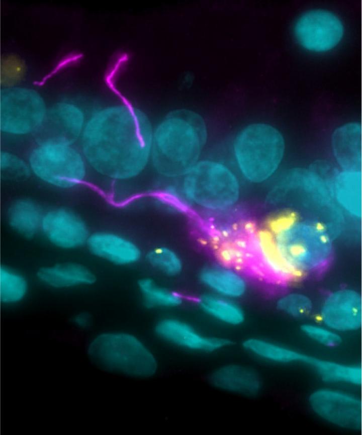 Nerve cell inside olfactory mucosa, infected with SARS-CoV-2