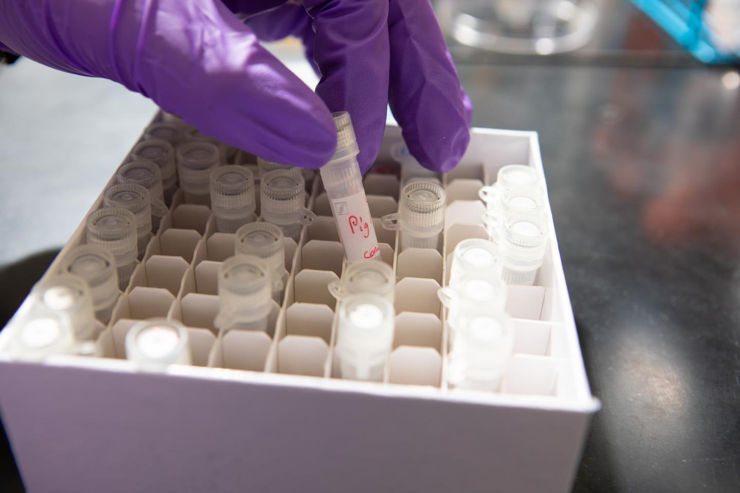 Saliva Samples [IMAGE] EurekAlert! Science News Releases