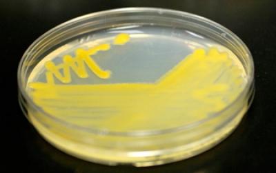 Bacteriain Perti Plate