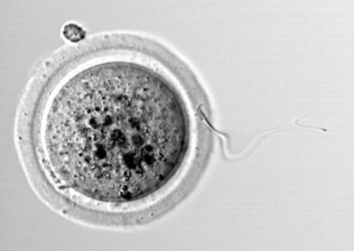 Sperm fertilising an egg