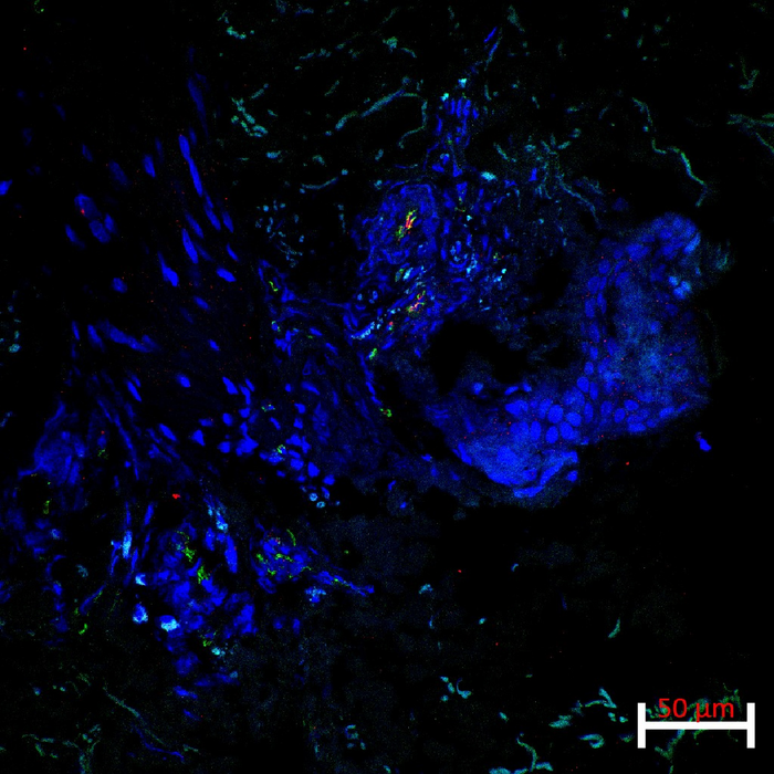 CD31 and the activation/adhesion marker, ICAM1