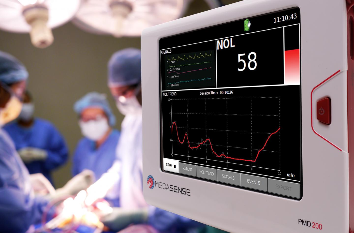 NOL pain monitoring