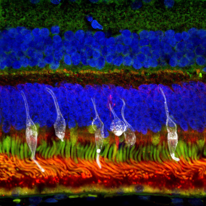 Retinal progenitor cells