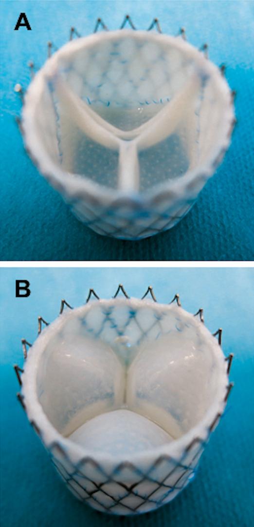 Growing LifeLike Heart Valves, Thanks to Hel EurekAlert!