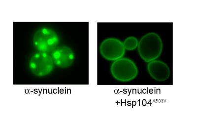 Alpha-synuclein Forms Lewy Body-like Inclusions