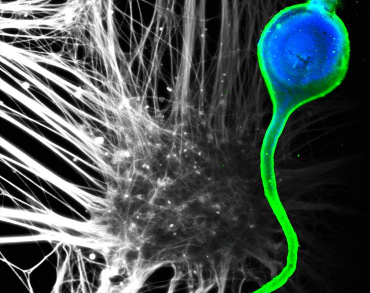 Image of Nerve Organoid