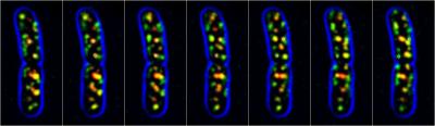 New View of Elongating Bacteria (3 of 5)