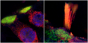 Proteins associated with age-related hearing loss