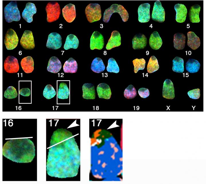 ATRX and Chromosome Stability