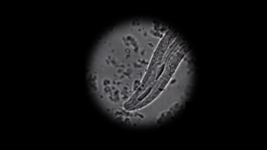 C elegans spits