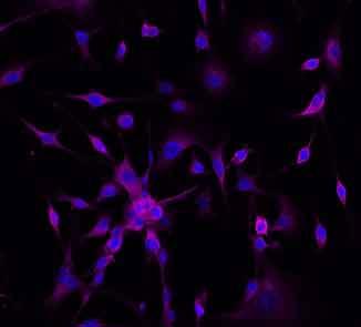 Fluorescence Microscopy Image of Nanobody Binding to Colorectal Cancer Cells