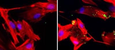 Macropinocytosis in stromal cells 