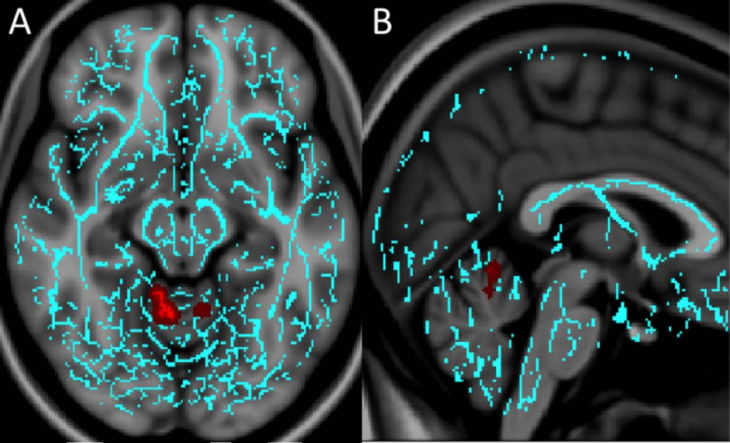 Axial & Sagittal Images