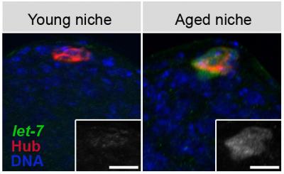 Researchers Find a Way to Delay Aging of Stem Cells