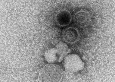 Epstein-Barr Virus Particles