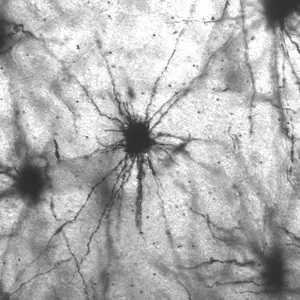 Metformin enhances frontal lobe dendrites in elderly monkeys